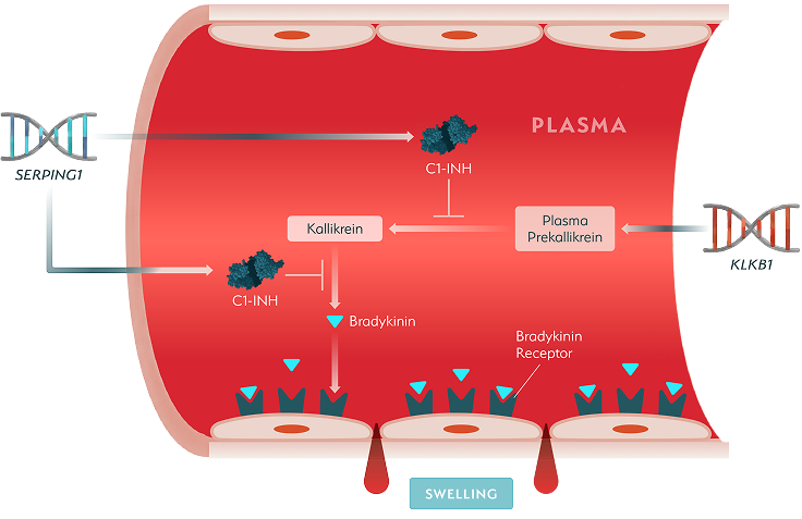 A diagram showing how HAE swelling attacks begin with an internal chain reaction. It shows how the SERPING1 gene makes C1-INH, which helps to control the swelling. When there is too little C1-INH or if it doesn't work properly, bradykinin can build up and cause swelling.
